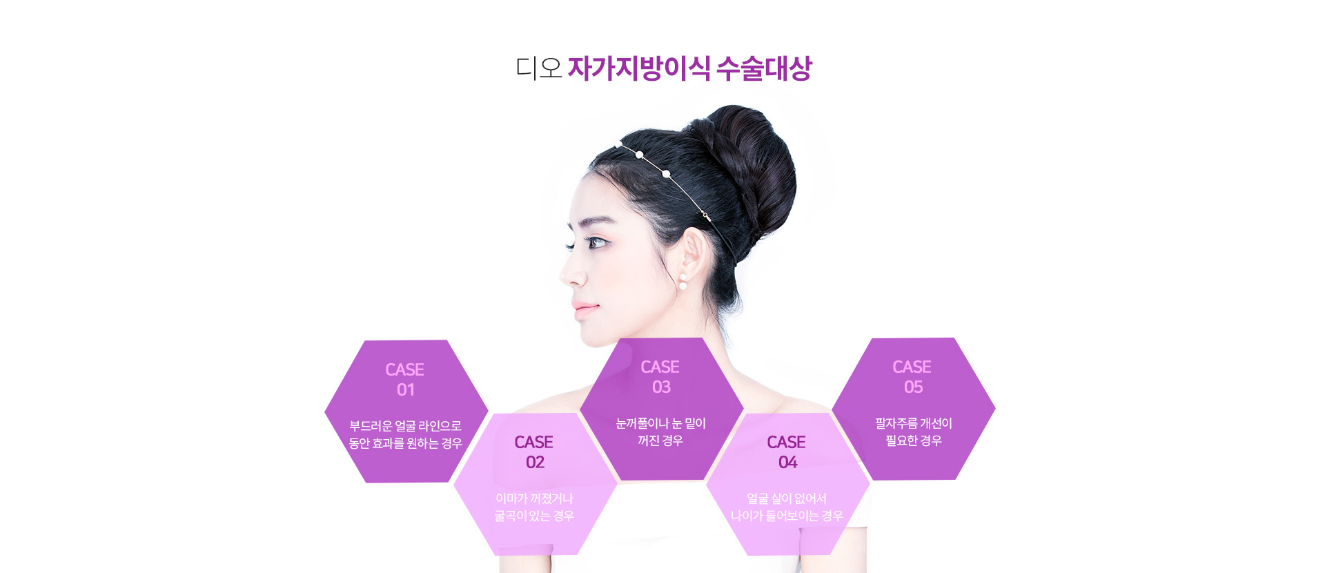 디오 자가지방이식 수술대상 — 부드러운 얼굴 라인으로 동안 효과를 원하는 경우, 이마가 꺼졌거나 굴곡이 있는 경우, 눈꺼풀이나 눈 밑이 꺼진 경우, 얼굴 살이 없어서 나이가 들어보이는 경우, 팔자주름 개선이 필요한 경우