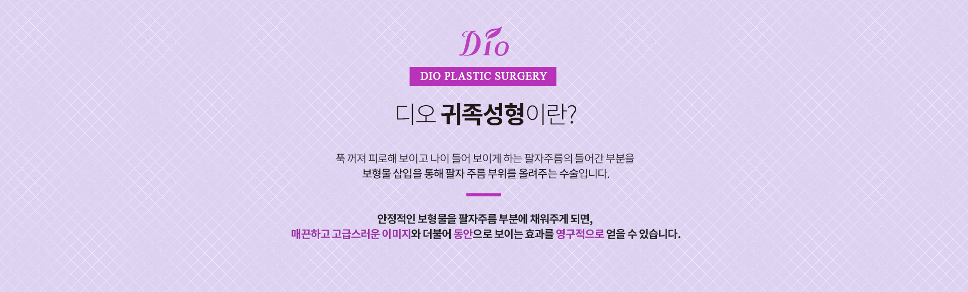 귀족성형이란?