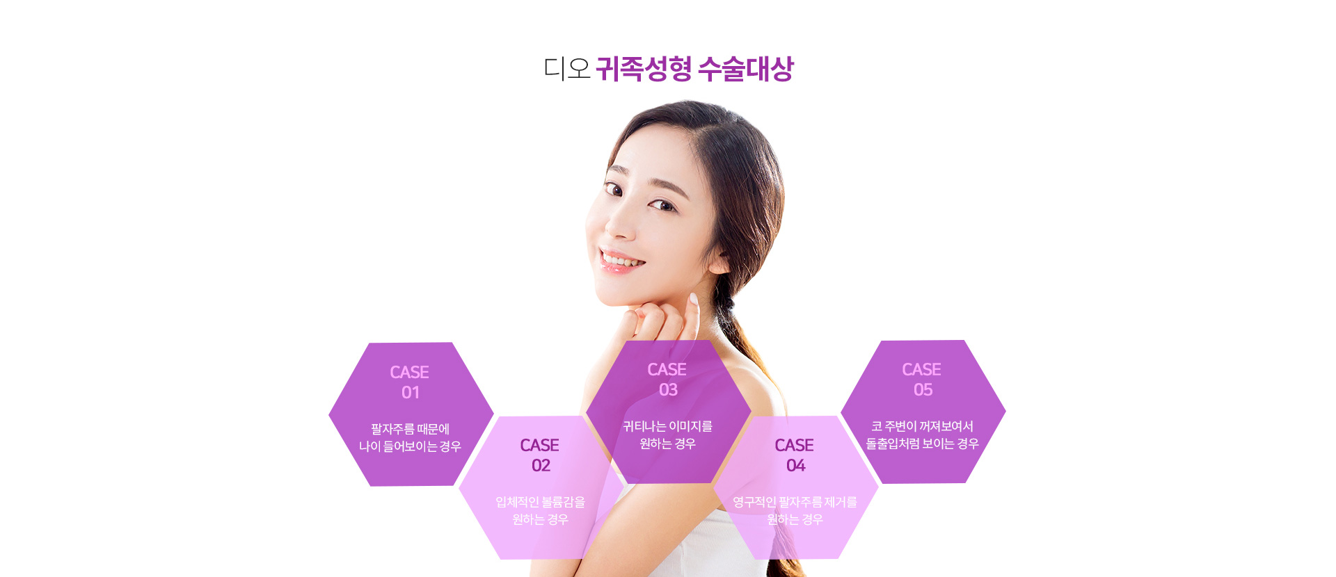 귀족성형이 필요한경우