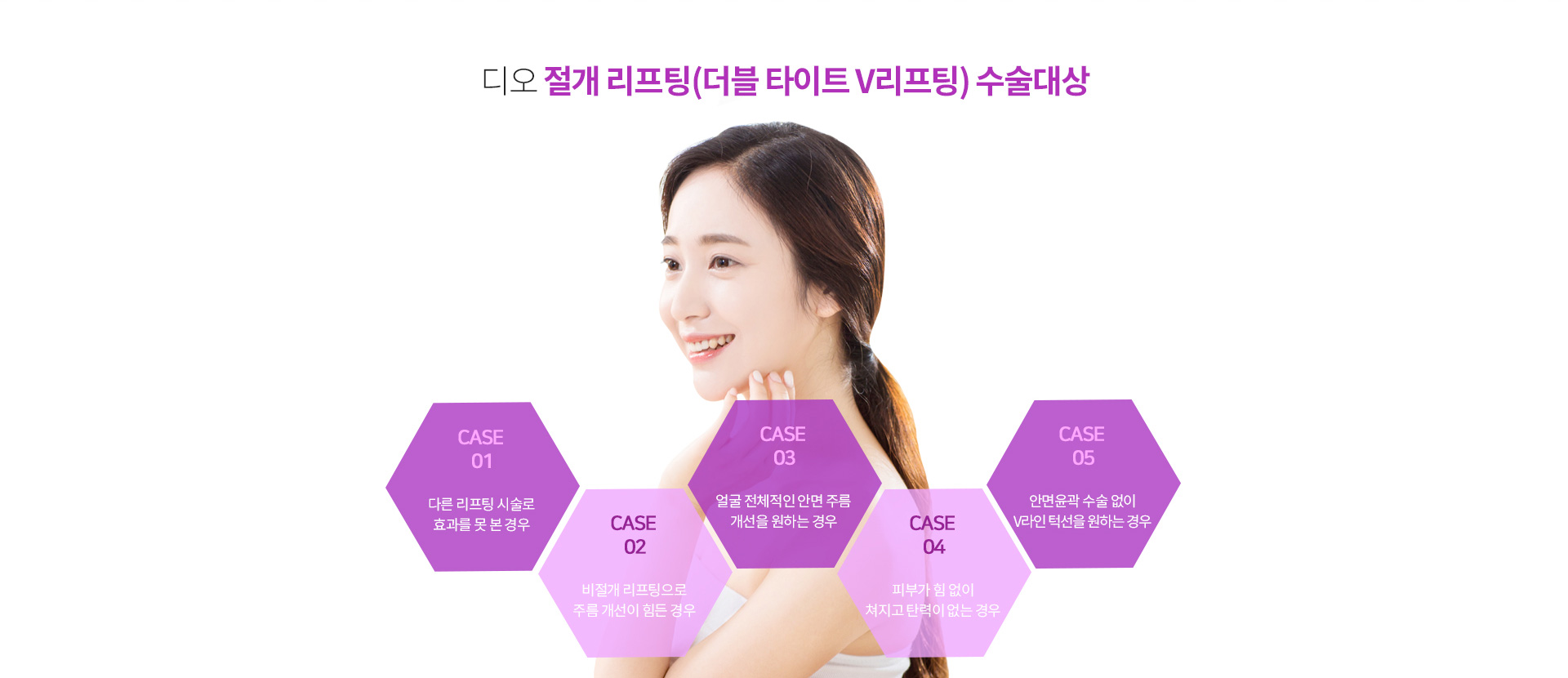 절개리프팅이 필요한 경우