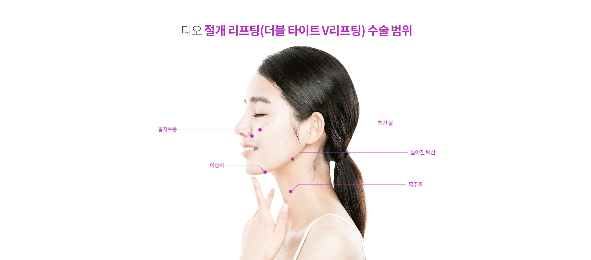 절개리프팅 수술 범위