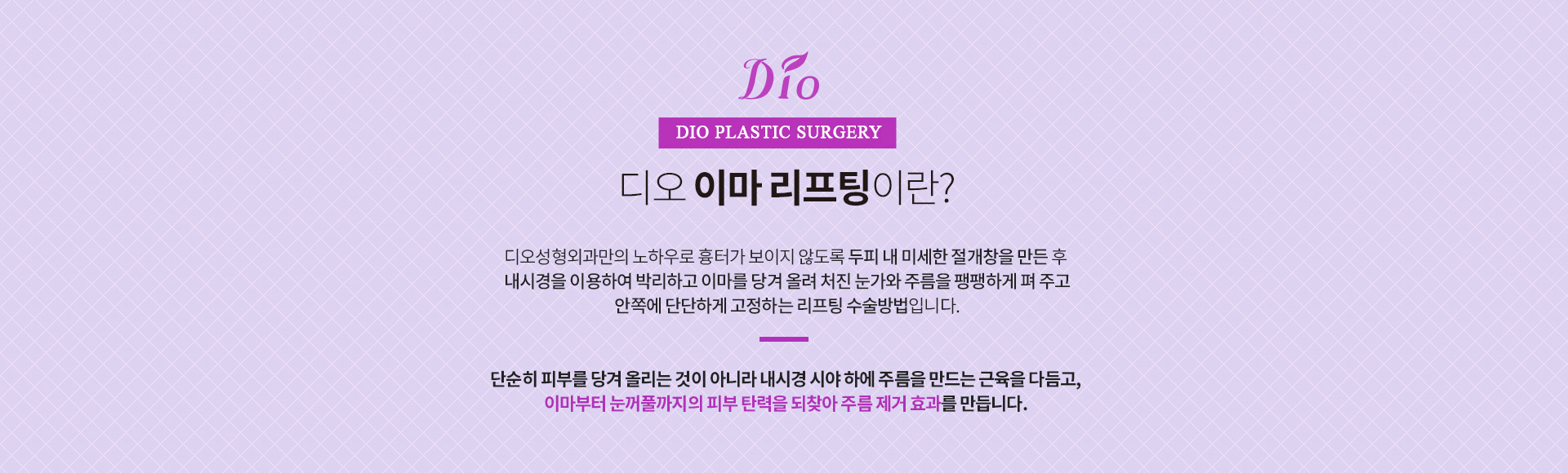 이마 리프팅이란?