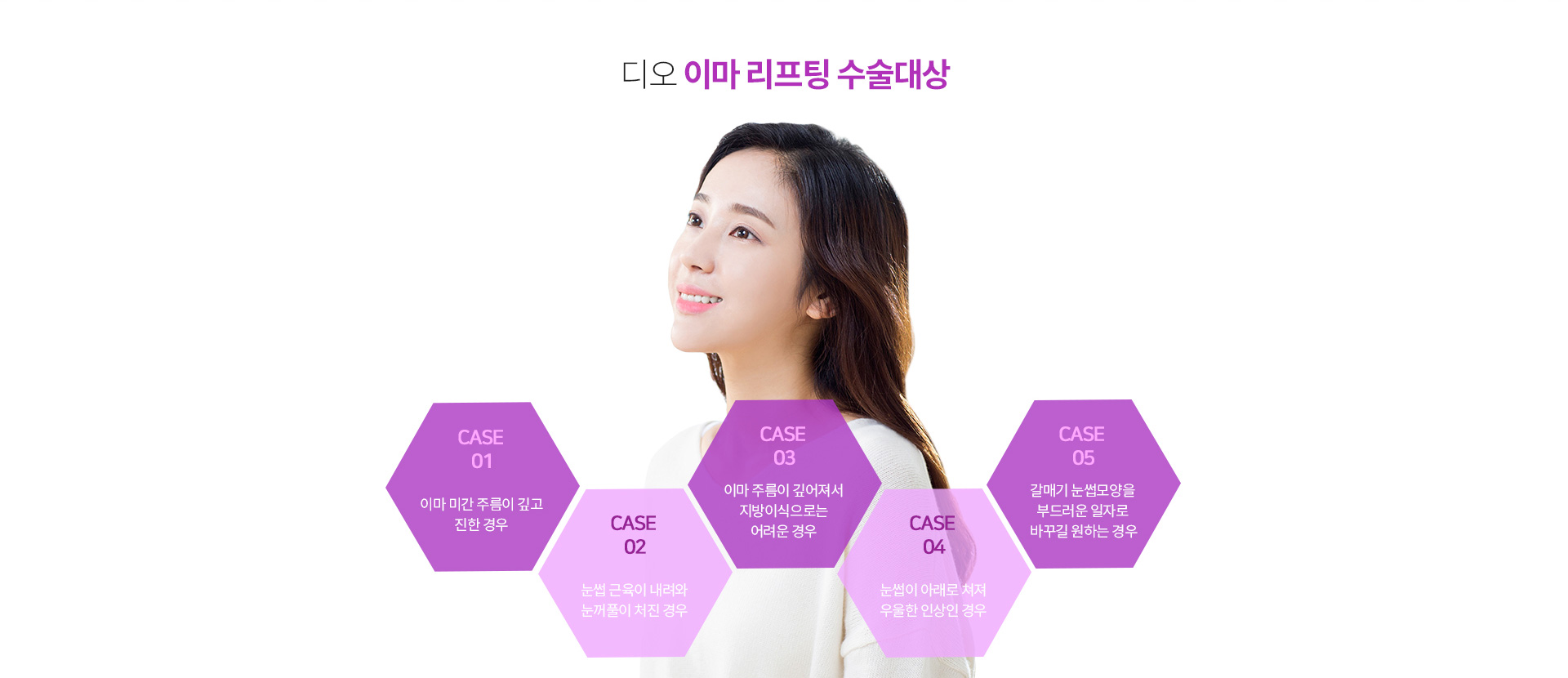 이마 리프팅이 필요한 경우