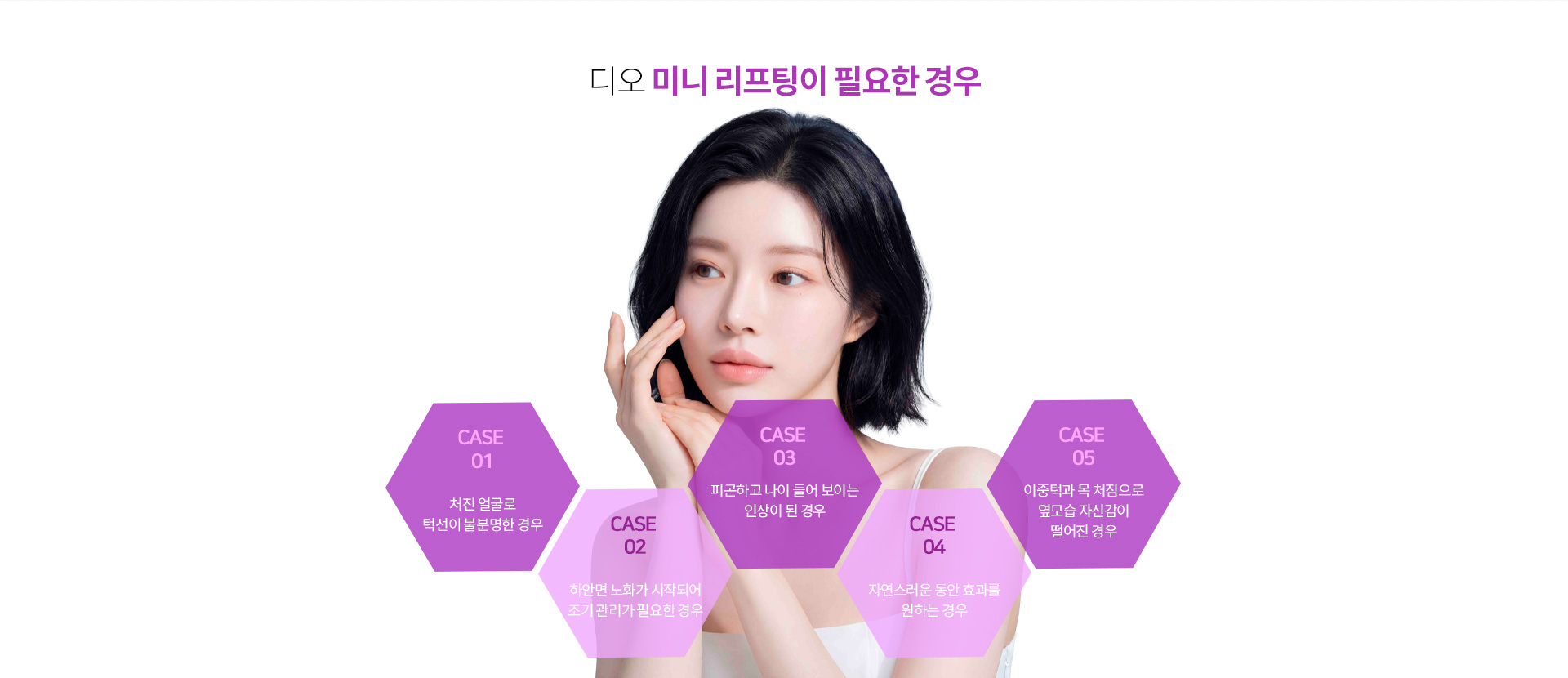 미니리프팅이 도움이 될 수 있는 대표적인 사례를 안내하는 이미지.