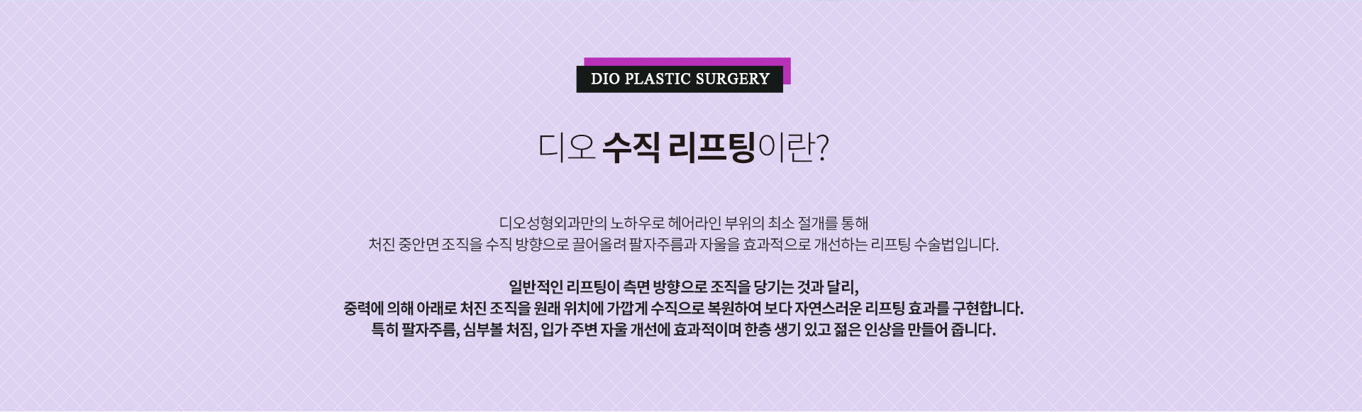 헤어라인 최소 절개를 통해 처진 중안면 조직을 수직 방향으로 당겨 팔자주름과 볼 처짐 개선을 목표로 하는 디오 수직리프팅 수술을 설명하는 이미지.
