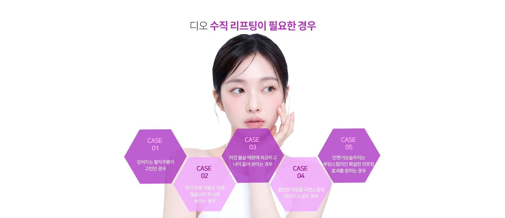 수직리프팅이 도움이 될 수 있는 대표적인 사례를 안내하는 이미지.