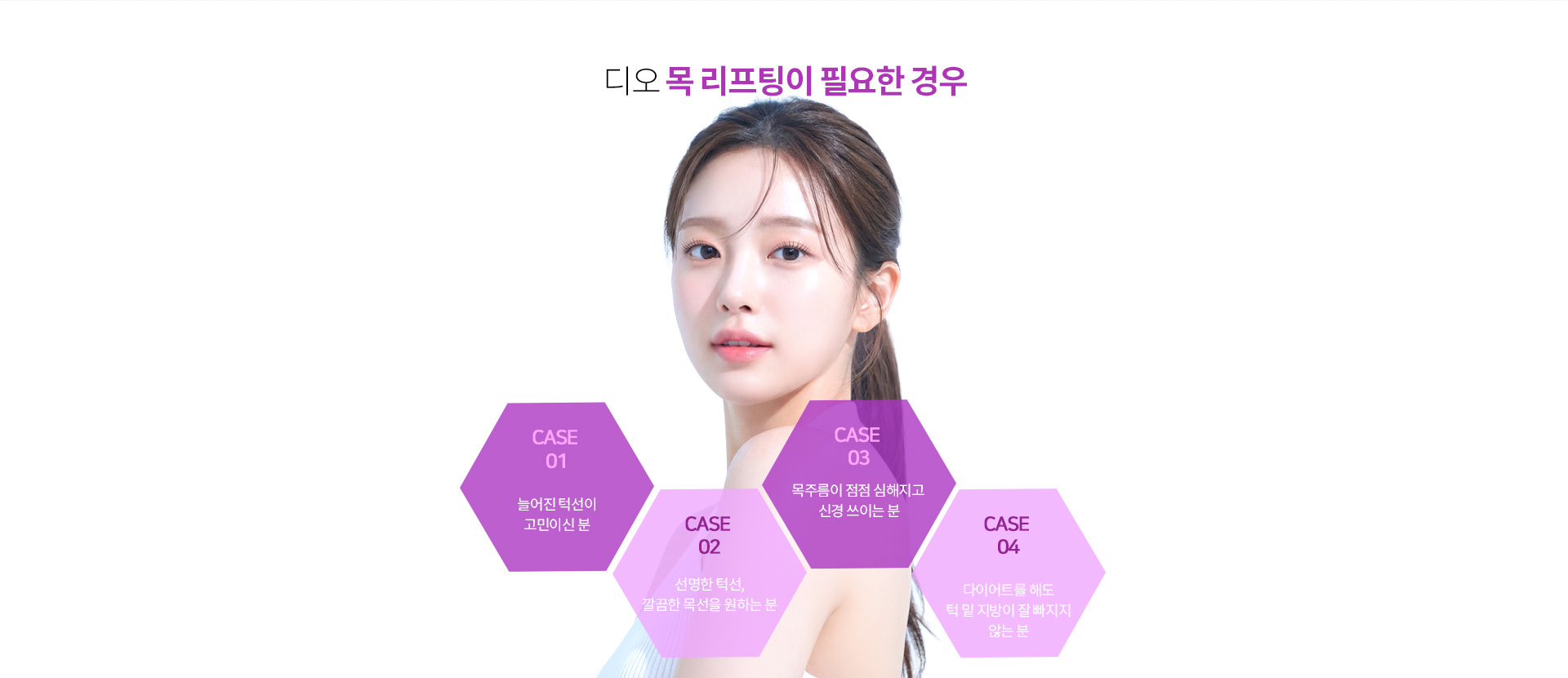 목리프팅이 도움이 될 수 있는 대표적인 사례를 안내하는 이미지.