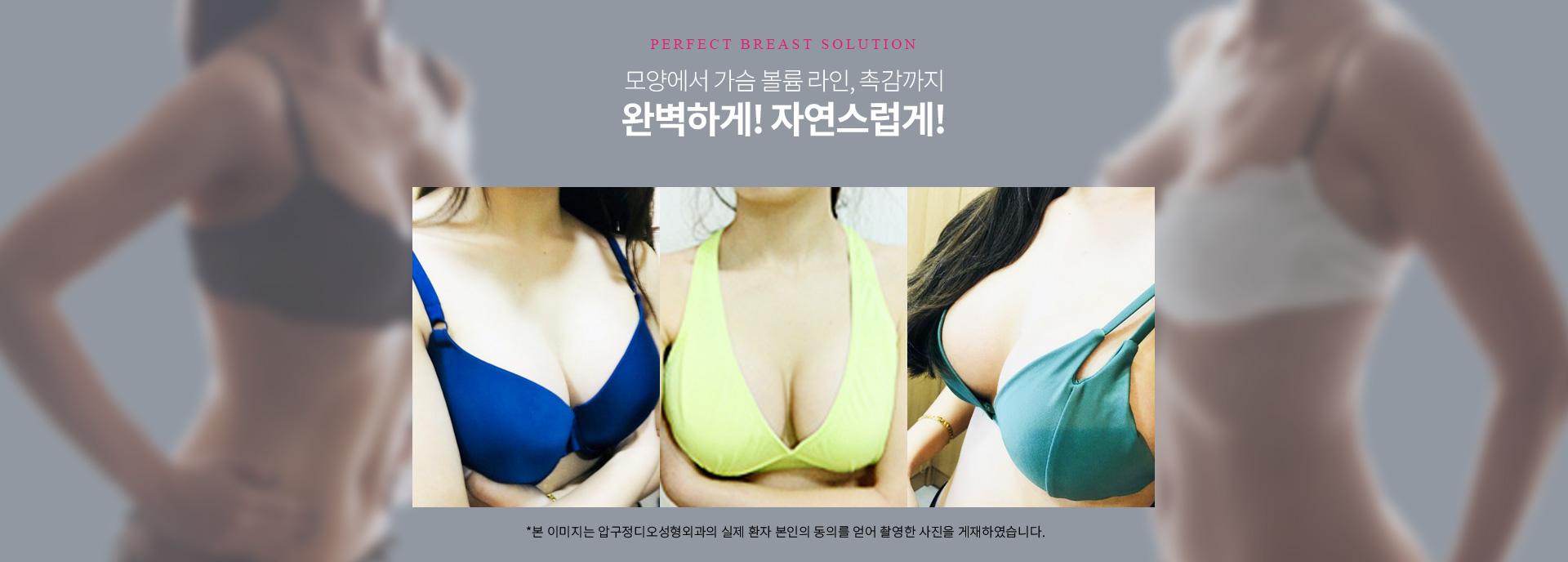 모양에서 가슴 볼륨 라인, 촉감까지 — 디오성형외과 가슴성형 (본 이미지는 실제 환자 본인의 동의를 얻어 촬영한 사진입니다)