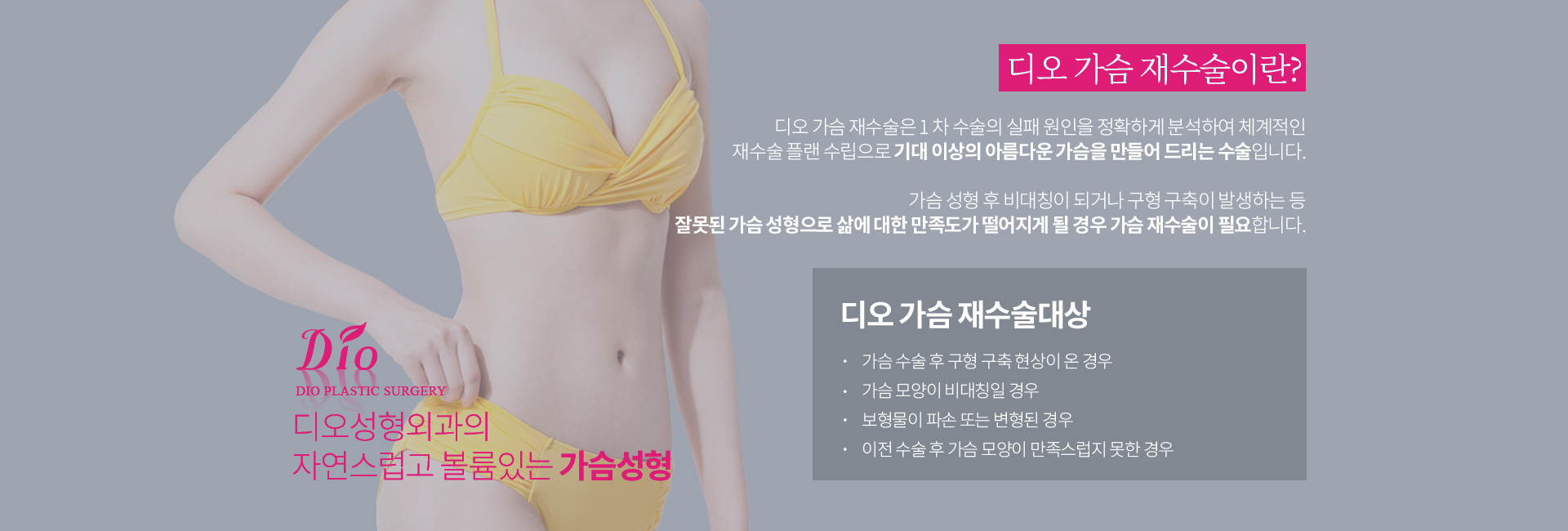 디오 가슴 재수술이란? 1차 수술의 실패 원인을 정확하게 분석하여 체계적인 재수술 플랜을 수립하는 수술. 수술대상 — 가슴 수술 후 구형 구축 현상이 온 경우, 가슴 모양이 비대칭일 경우, 보형물이 파손 또는 변형된 경우, 이전 수술 후 가슴 모양이 만족스럽지 못한 경우