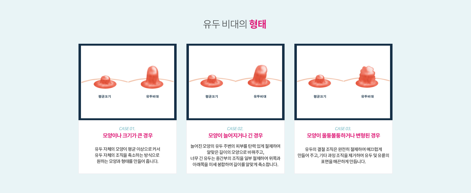 유두 비대의 형태 — 모양이나 크기가 큰 경우는 유두 자체의 조직을 축소, 모양이 늘어지거나 긴 경우는 주변 피부를 절제하고 중간부 조직을 일부 절제하여 길이를 축소, 모양이 울퉁불퉁하거나 변형된 경우는 결절 조직을 절제하고 과잉 조직을 제거해 유두 및 유륜 표면을 매끄럽게