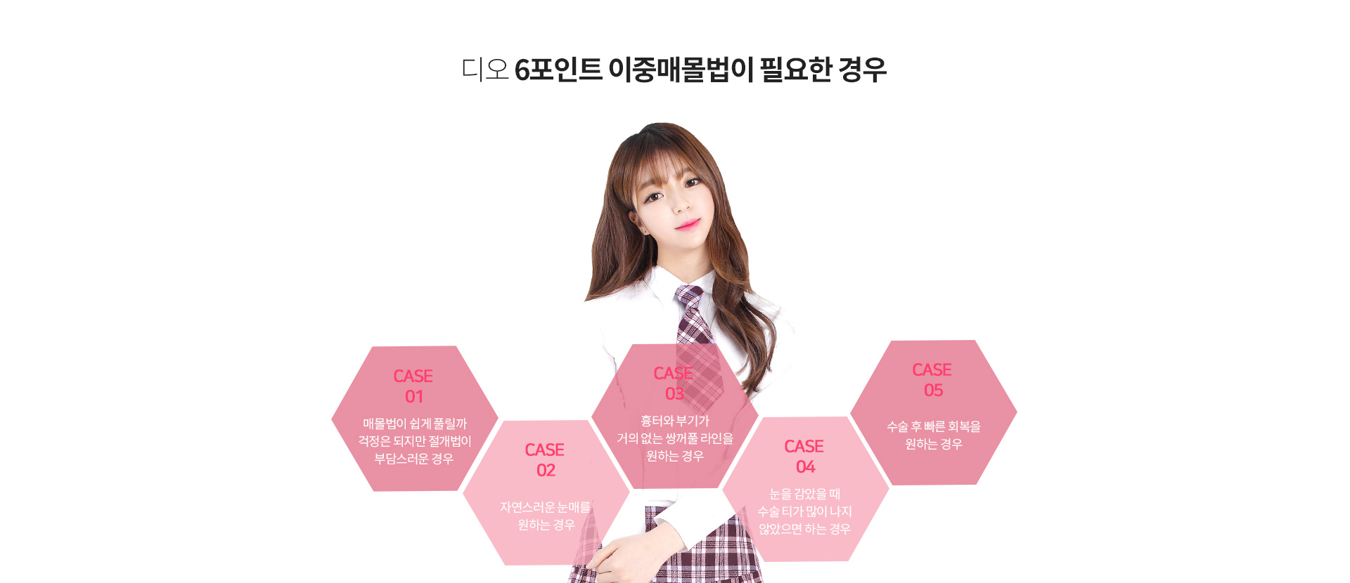 이중매몰이 필요한 경우