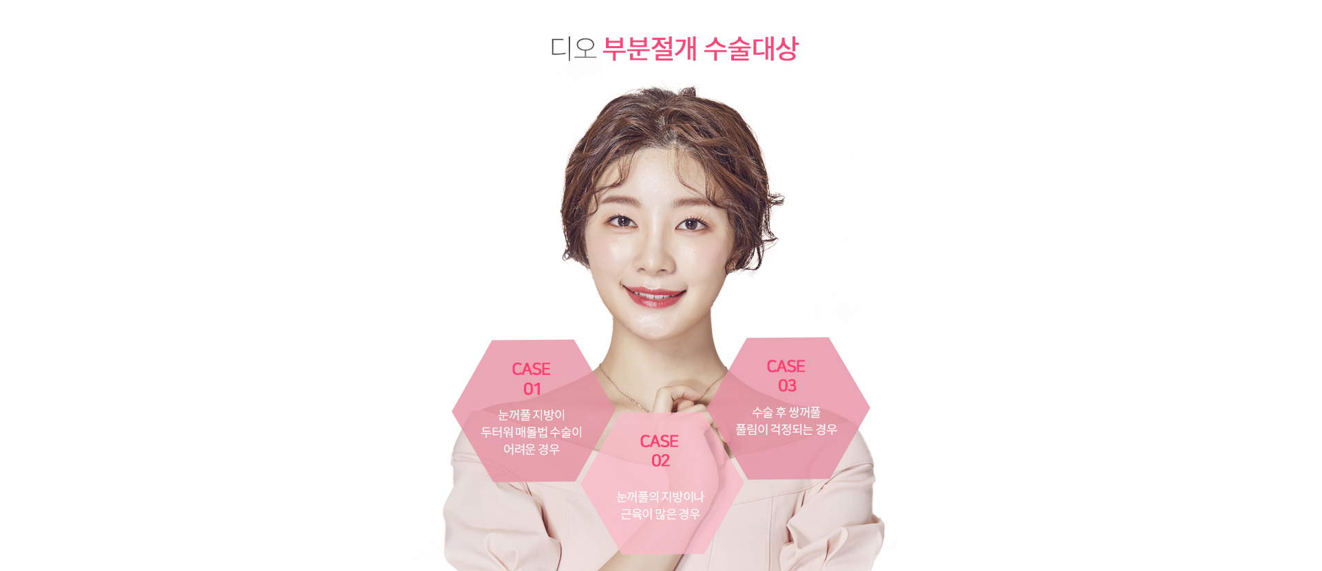 부분절개가 필요한 경우