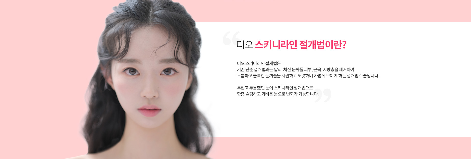 스키니라인 절개법이란?