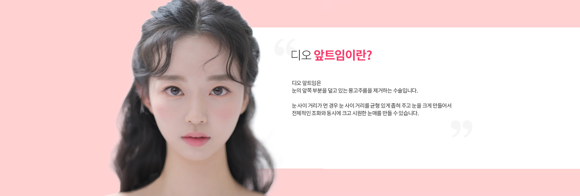 앞트임이란?