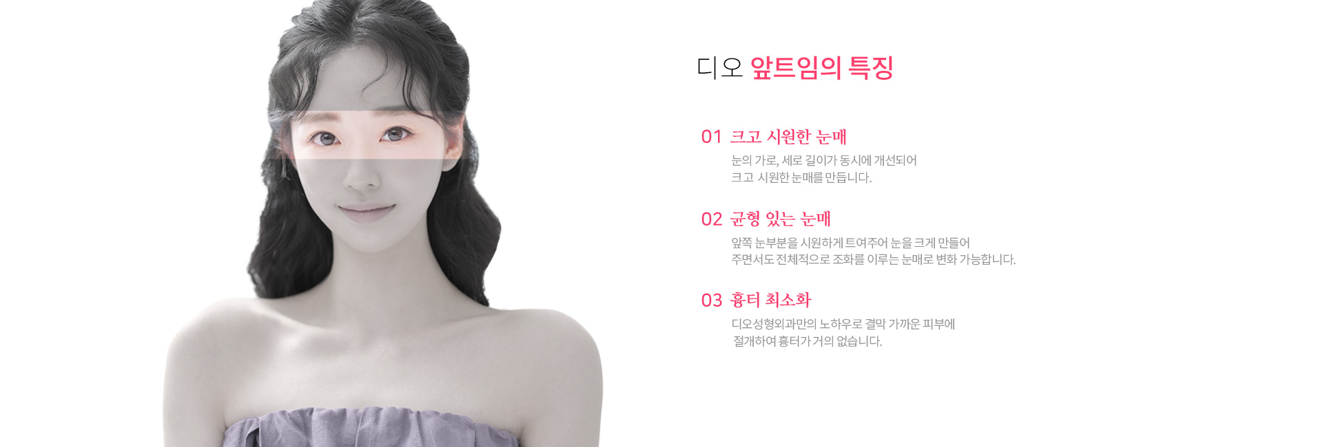 앞트임 효과