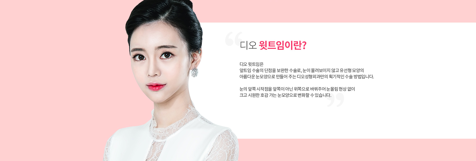 디오 윗트임이란? 앞트임 수술의 단점을 보완해 눈이 몰려 보이지 않는 유선형 눈모양을 만드는 수술. 눈의 앞쪽 시작점을 위쪽으로 바꿔 눈몰림 없이 크고 시원한 눈매로