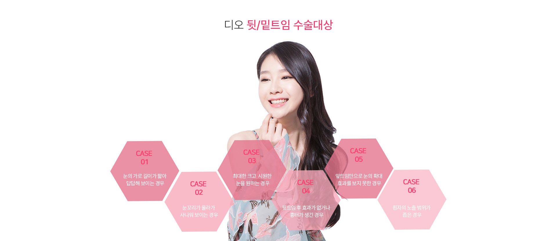 뒷트임이 필요한 경우