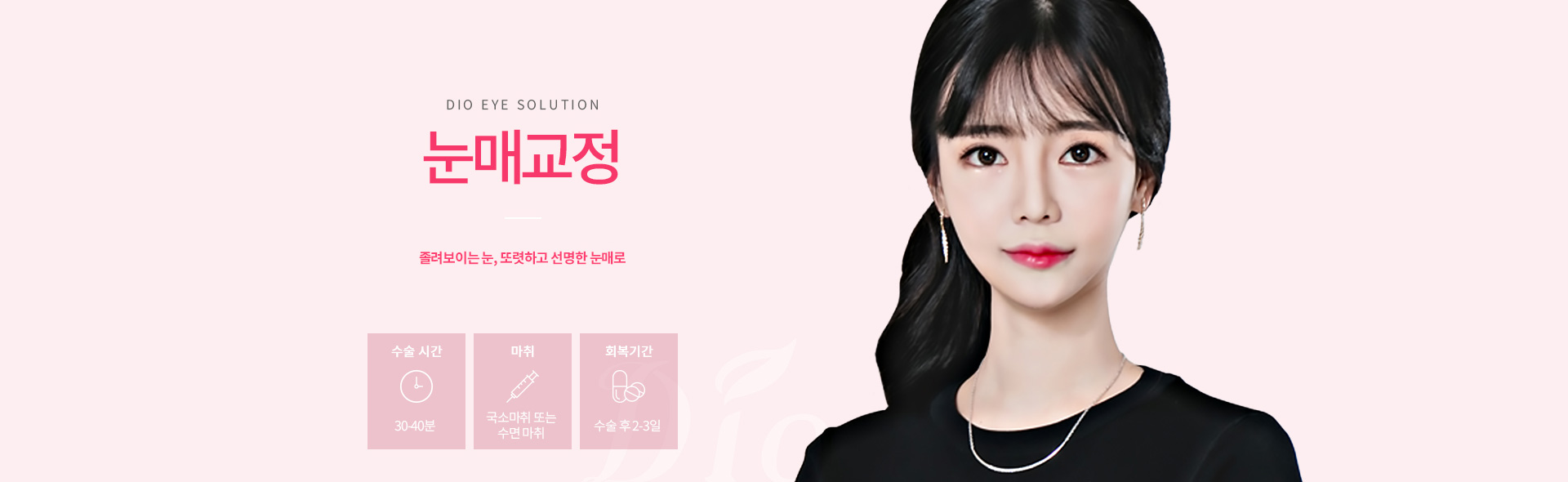 디오성형외과 눈매교정 — 졸려보이는 눈을 또렷하고 선명한 눈매로, 수술시간 30-40분, 국소마취 또는 수면마취, 회복 수술 후 2-3일