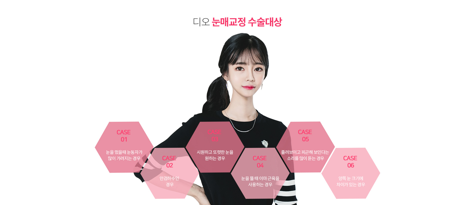 디오 눈매교정 수술대상 — 눈을 떴을 때 눈동자가 많이 가려지는 경우, 안검하수인 경우, 시원하고 또렷한 눈을 원하는 경우, 눈을 뜰 때 이마 근육을 사용하는 경우, 졸려보이고 피곤해 보인다는 소리를 많이 듣는 경우, 양쪽 눈 크기에 차이가 있는 경우