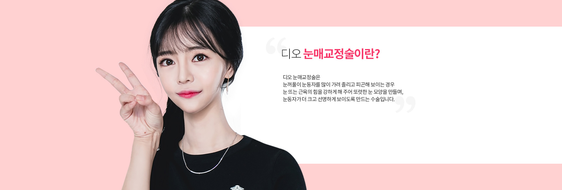 디오 눈매교정술이란? 눈꺼풀이 눈동자를 많이 가려 졸리고 피곤해 보이는 경우, 눈 뜨는 근육의 힘을 강하게 해 또렷한 눈 모양을 만들고 눈동자가 더 크고 선명하게 보이도록 만드는 수술