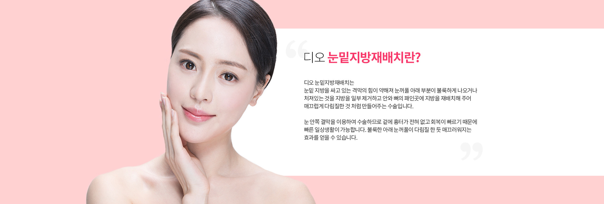 디오 눈밑지방재배치란? 눈밑 지방을 싸고 있는 격막의 힘이 약해져 눈꺼풀 아래가 볼록하게 나오거나 처진 것을, 지방을 일부 제거하고 안와뼈의 패인 곳에 재배치해 매끄럽게 만들어 주는 수술. 눈 안쪽 결막을 이용해 수술
