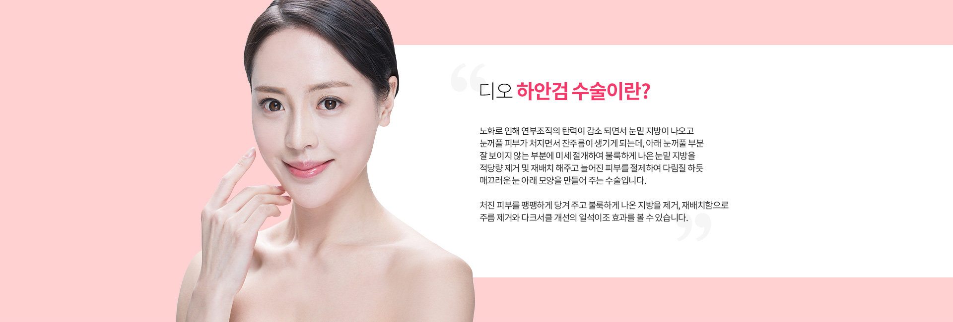 디오 하안검 수술이란? 노화로 연부조직 탄력이 감소하면서 눈밑 지방이 나오고 눈꺼풀 피부가 처져 잔주름이 생기는 것을, 아래 눈꺼풀의 잘 보이지 않는 부분에 미세 절개해 볼록한 눈밑 지방을 적당량 제거·재배치하고 늘어진 피부를 절제해 매끄러운 눈 아래 모양을 만드는 수술