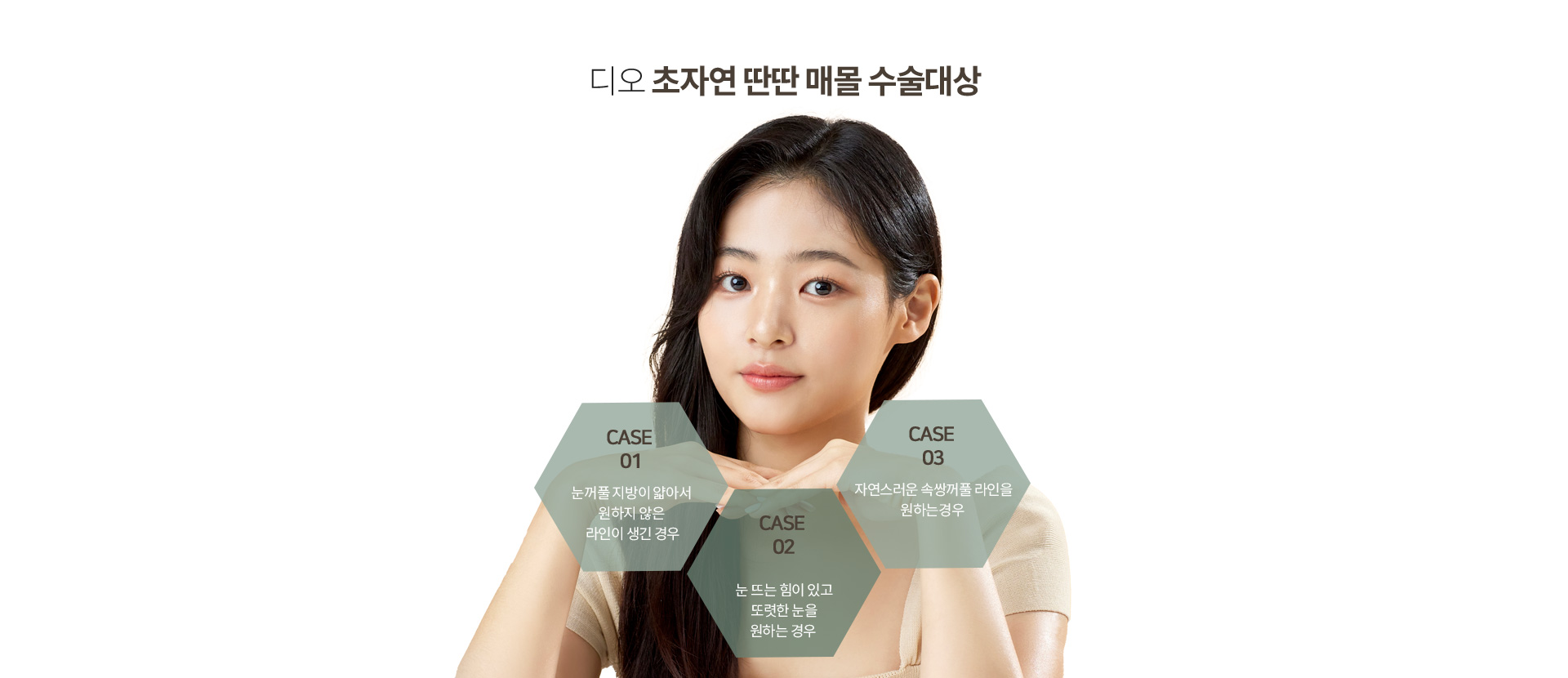 디오 초자연 딴딴 매몰 수술대상 — 눈꺼풀 지방이 얇아 원하지 않는 라인이 생긴 경우, 눈 뜨는 힘이 있고 또렷한 눈을 원하는 경우, 자연스러운 속쌍꺼풀 라인을 원하는 경우