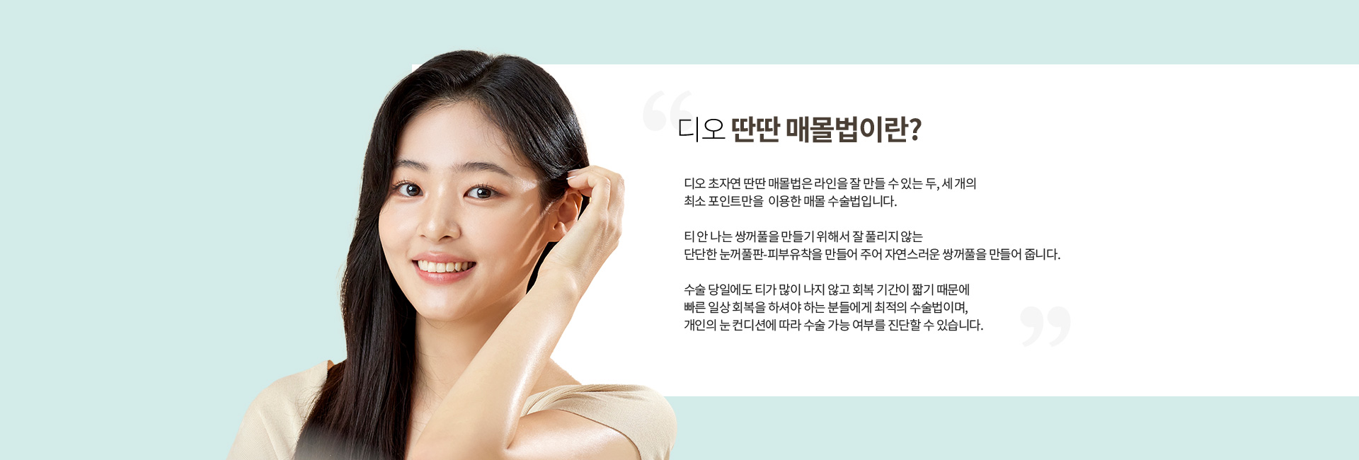 디오 딴딴 매몰법이란? 2~3개의 최소 포인트만 이용하는 매몰 쌍꺼풀 수술법