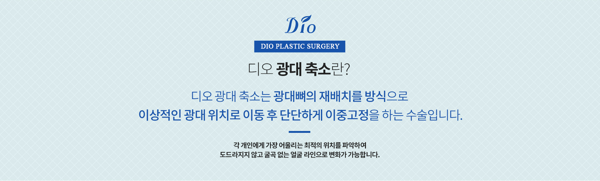 광대축소술이란?