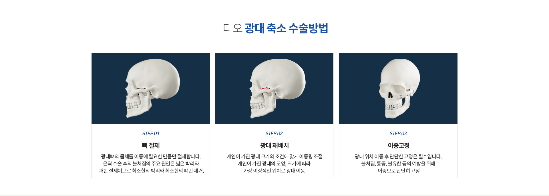 광대축소 수술방법