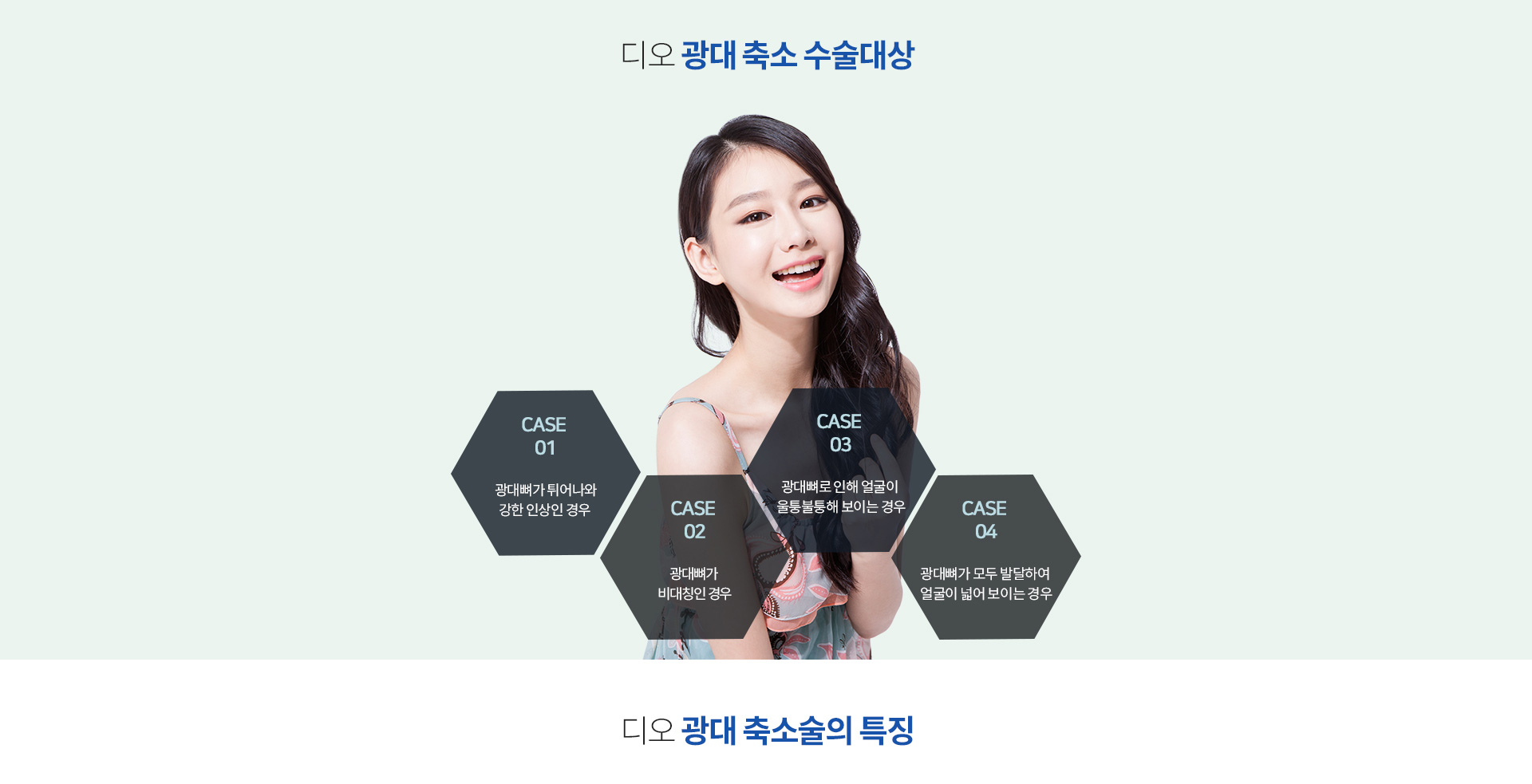 광대축소가 필요한 경우 