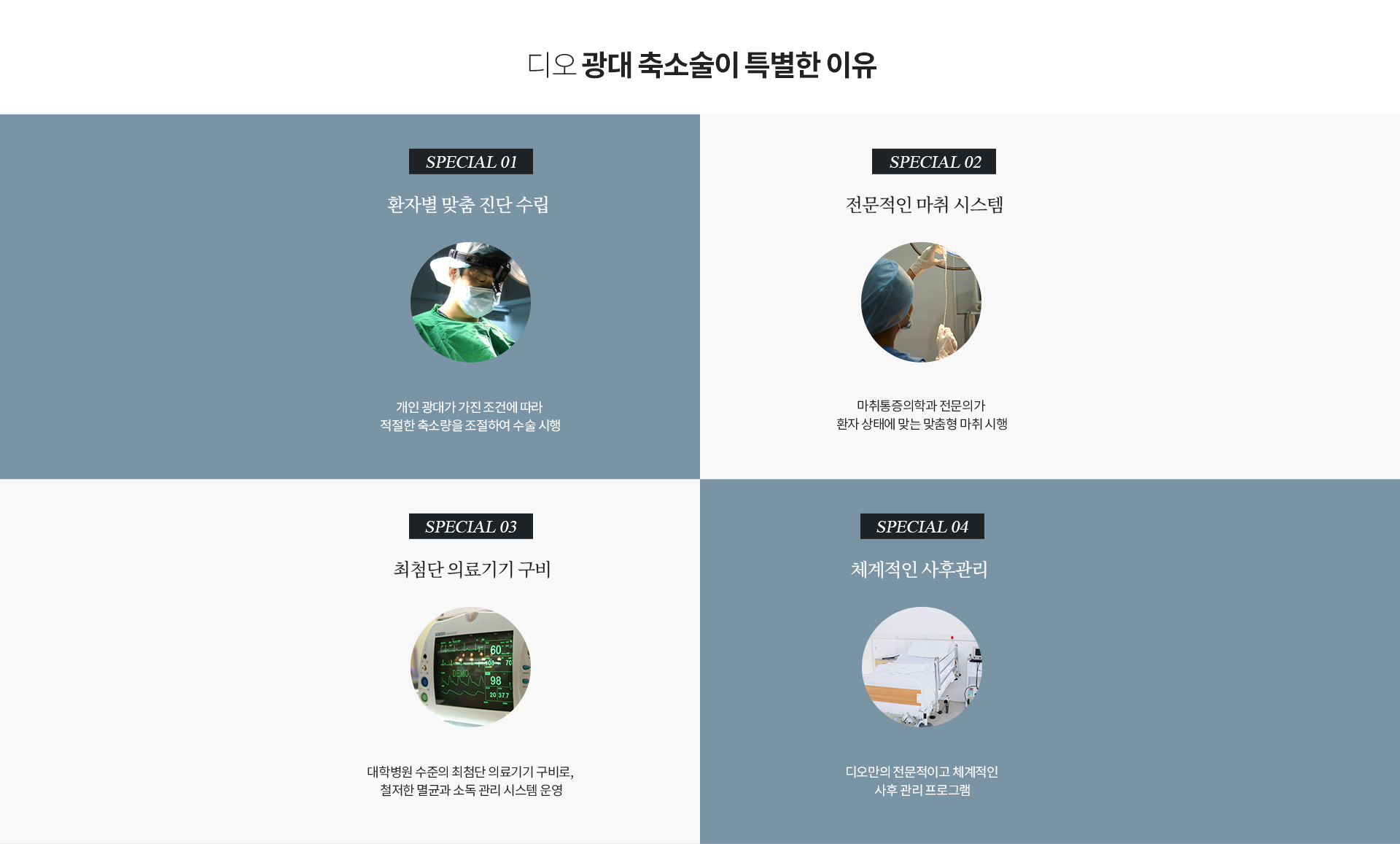 광대축소특별한 이유