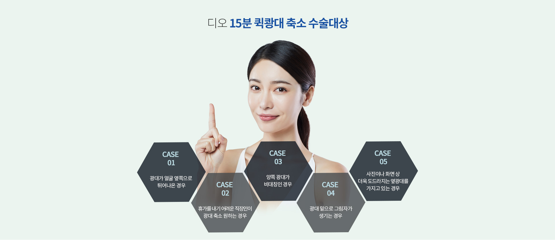 15분 퀵광대 축소가 필요한 경우 