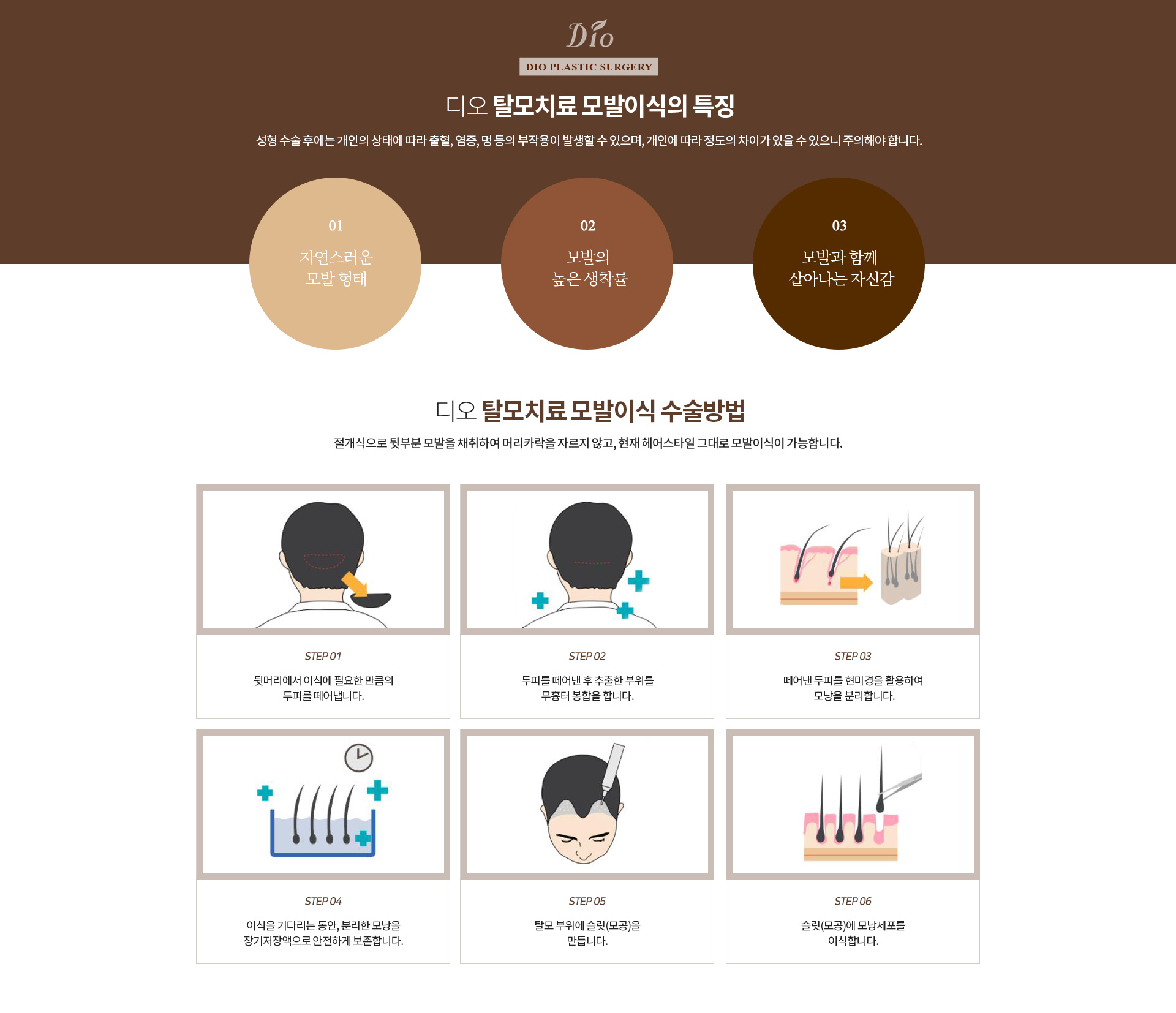 탈모치료 모발이식 효과