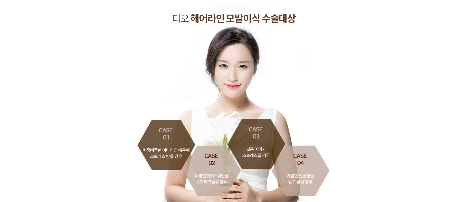 헤어라인 모발이식이 필요한 경우