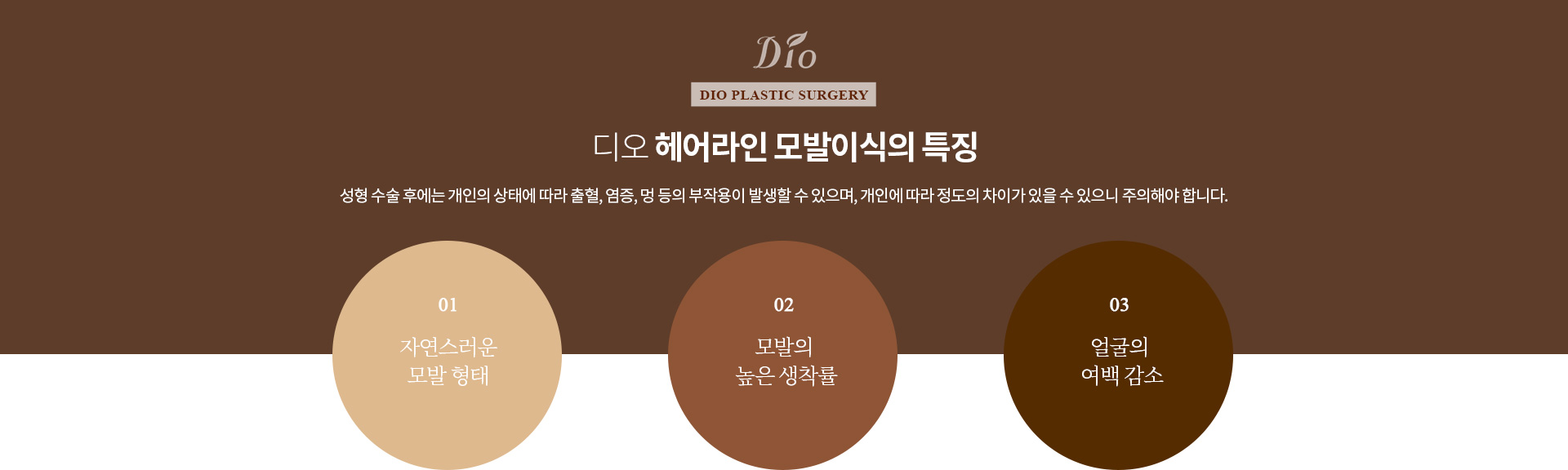 헤어라인 모발이식 효과