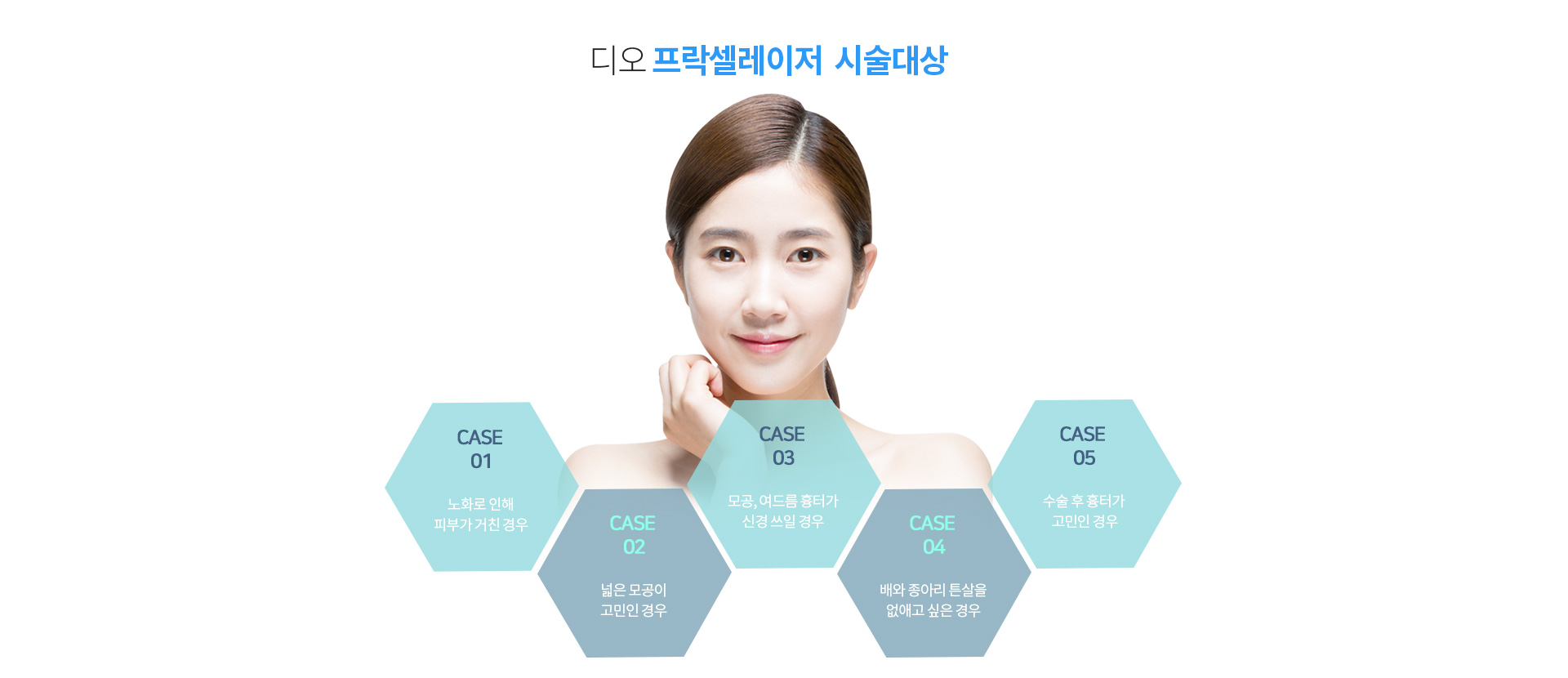 프락셀 레이저가 필요한 경우