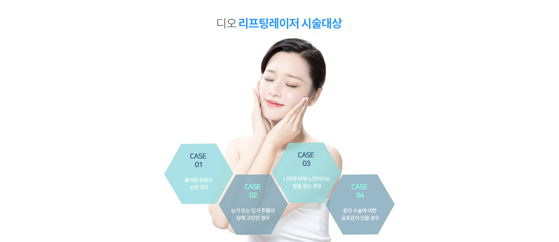 리프팅 레이저가 필요한 경우