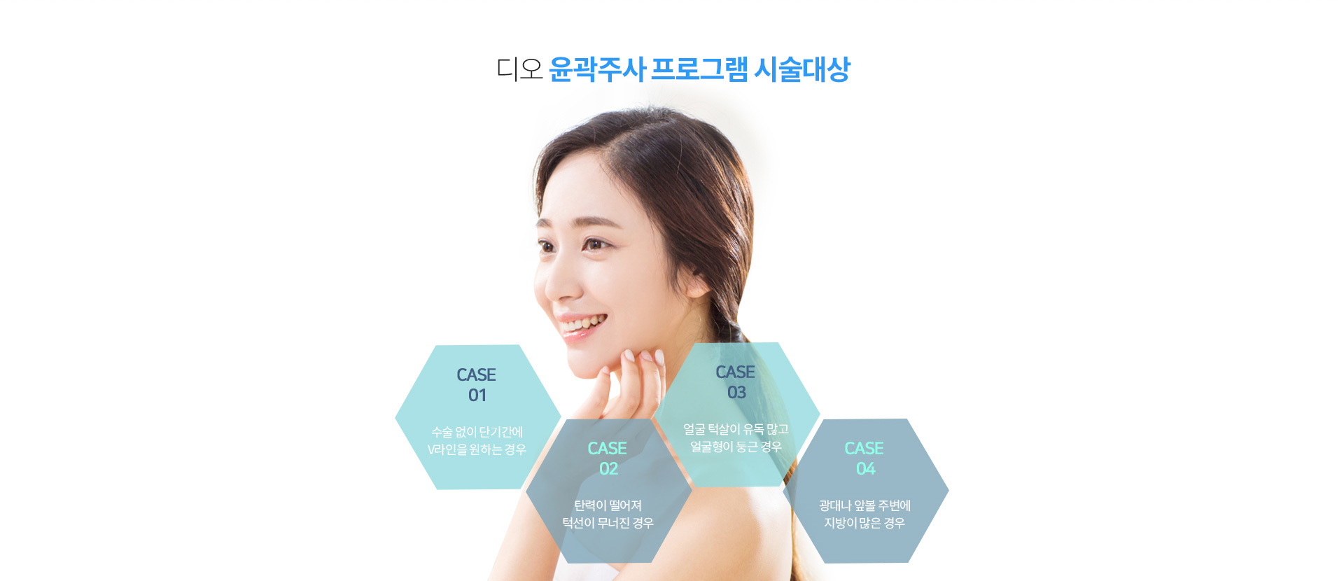 윤곽주사가 필요한 경우