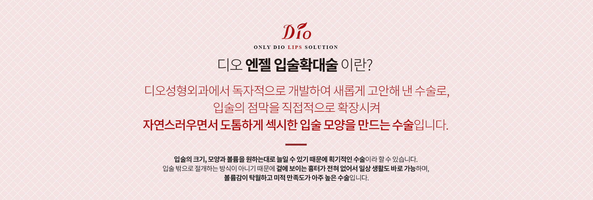 안젤리나입술확대술 엔젤입술확대술이란?