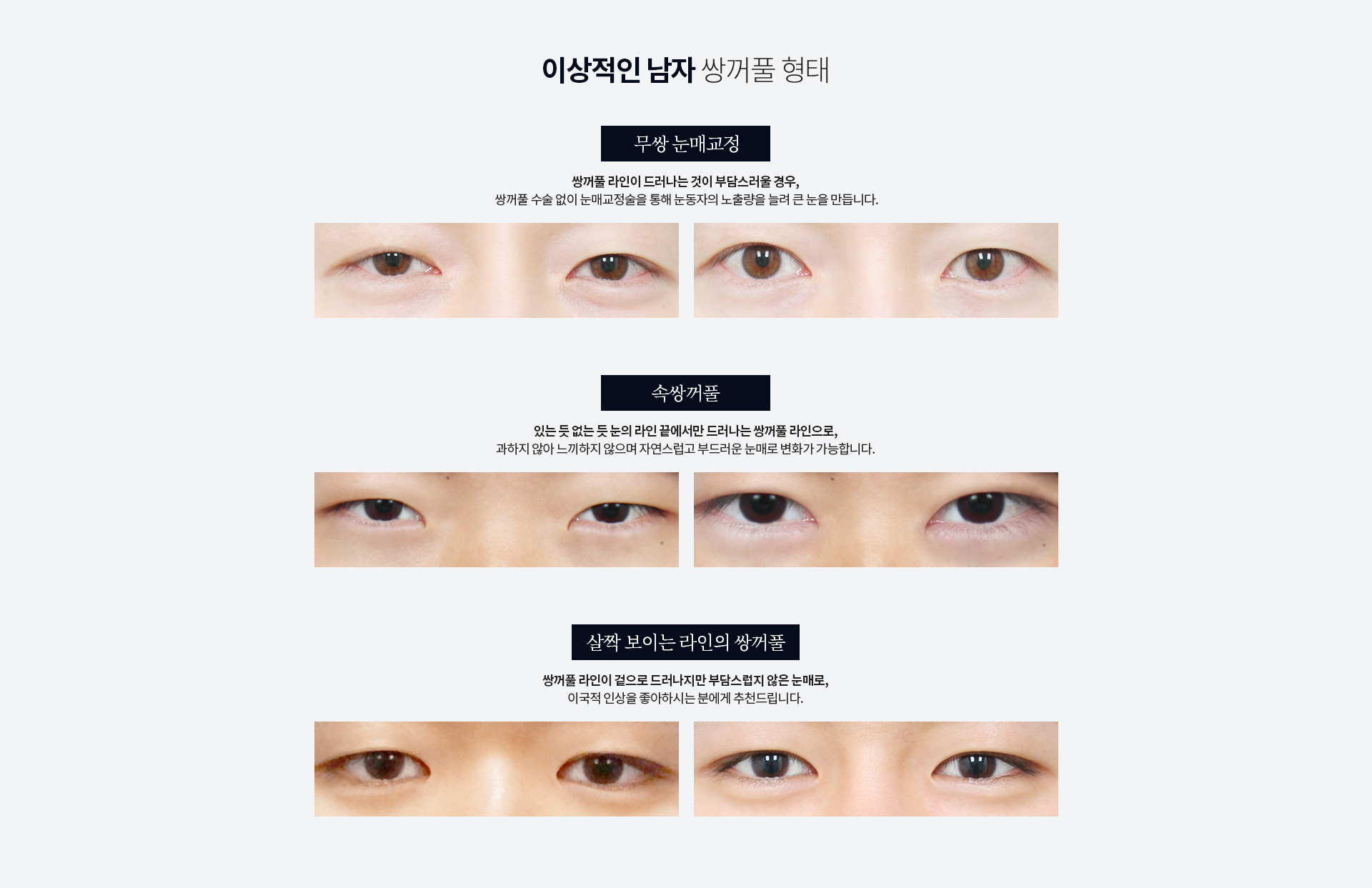 이상적인 남자 쌍꺼풀 형태 — 무쌍 눈매교정은 쌍꺼풀 라인이 드러나는 것이 부담스러울 경우 쌍꺼풀 수술 없이 눈동자 노출량을 늘려 큰 눈을, 속쌍꺼풀은 있는 듯 없는 듯 눈의 라인 끝에서만 드러나는 라인을, 살짝 보이는 라인의 쌍꺼풀은 이국적 인상을 원하는 경우