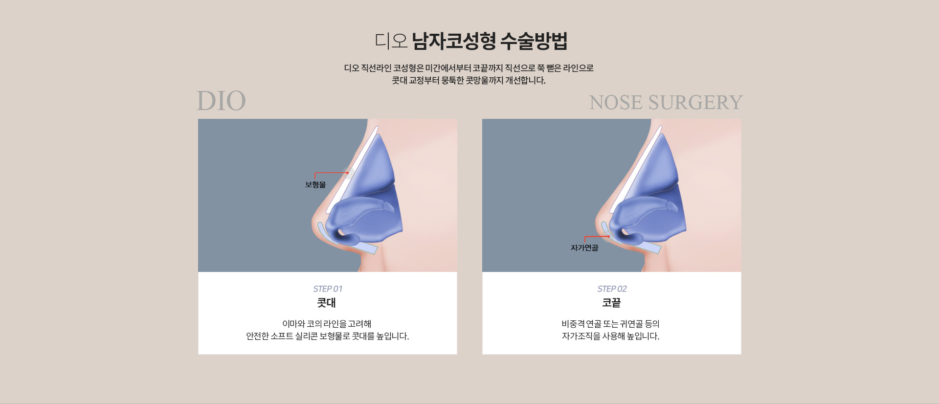 디오 남자코성형 수술방법 — 콧대는 이마와 코의 라인을 고려해 안전한 소프트 실리콘 보형물로 높이고, 코끝은 비중격 연골 또는 귀연골 등의 자가조직을 사용해 높입니다