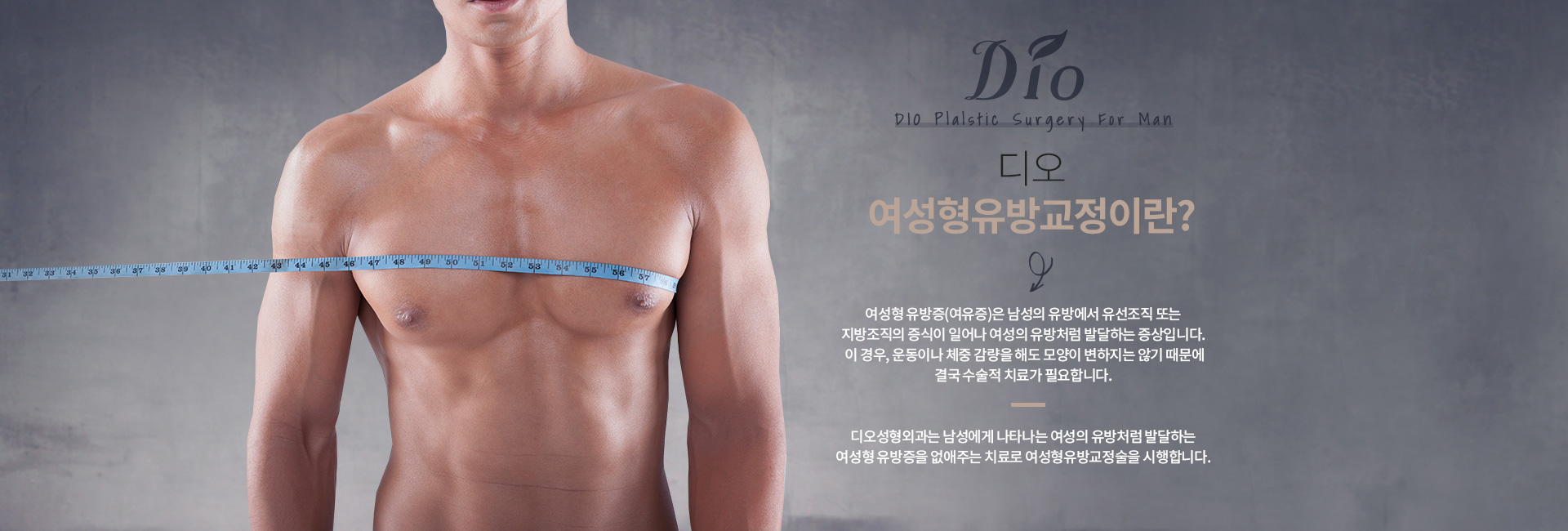 디오 여성형유방교정이란? 여성형 유방증(여유증)은 남성의 유방에서 유선조직 또는 지방조직의 증식이 일어나 여성의 유방처럼 발달하는 증상으로, 운동이나 체중 감량을 해도 모양이 변하지 않기 때문에 수술적 치료가 필요합니다