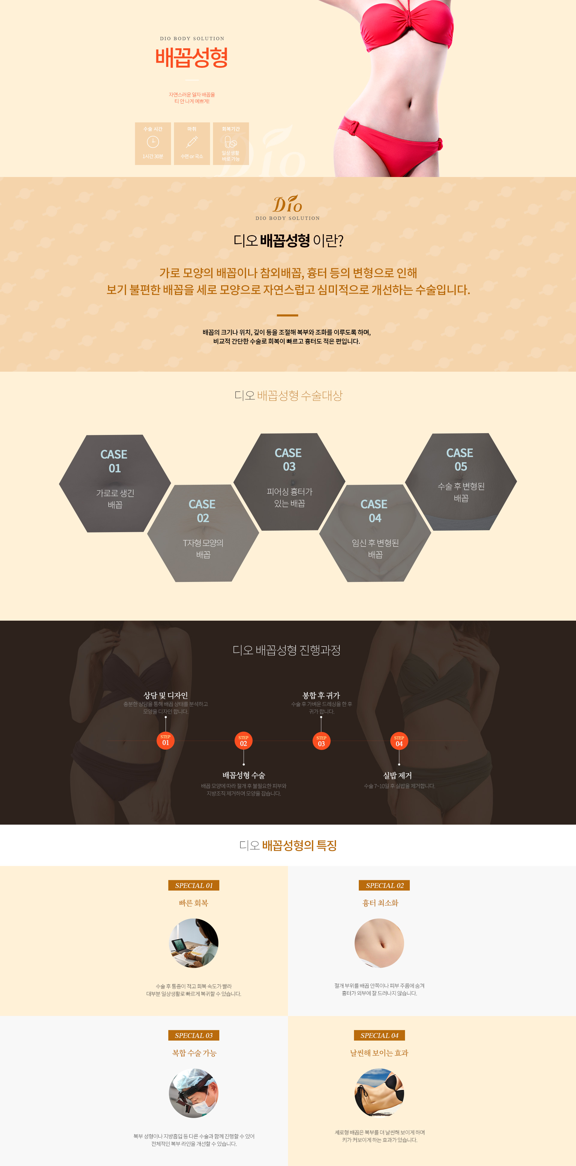 디오성형외과 배꼽성형 — 자연스러운 일자 배꼽을 티 안 나게 예쁘게. 수술시간 1시간 30분, 수면 또는 국소마취, 일상생활 바로 가능. 가로 모양의 배꼽이나 참외배꼽·흉터 등의 변형으로 보기 불편한 배꼽을 세로 모양으로 개선하는 수술이며, 수술대상은 가로로 생긴 배꼽·T자형 배꼽·피어싱 흉터가 있는 배꼽·임신 후 변형된 배꼽·수술 후 변형된 배꼽. 진행과정은 상담 및 디자인, 배꼽성형 수술, 봉합 후 귀가, 수술 7~10일 후 실밥 제거