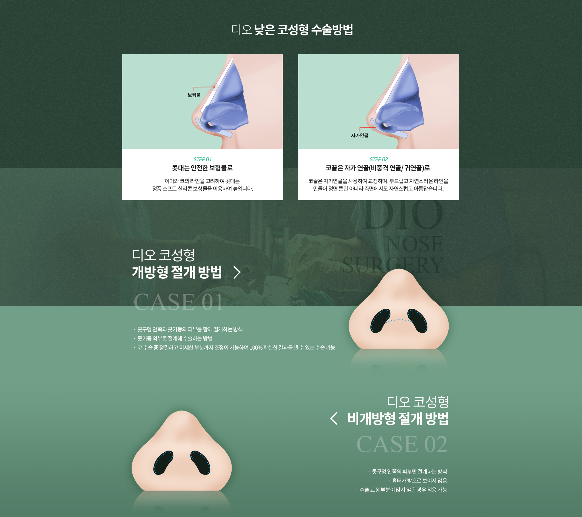 디오 낮은 코성형 수술방법 — 콧대는 정품 소프트 실리콘 보형물로, 코끝은 자가 연골(비중격 연골·귀연골)로 교정. 개방형 절개는 콧구멍 안쪽과 콧기둥 피부를 함께 절개하는 방식, 비개방형 절개는 콧구멍 안쪽 피부만 절개해 흉터가 밖으로 보이지 않는 방식