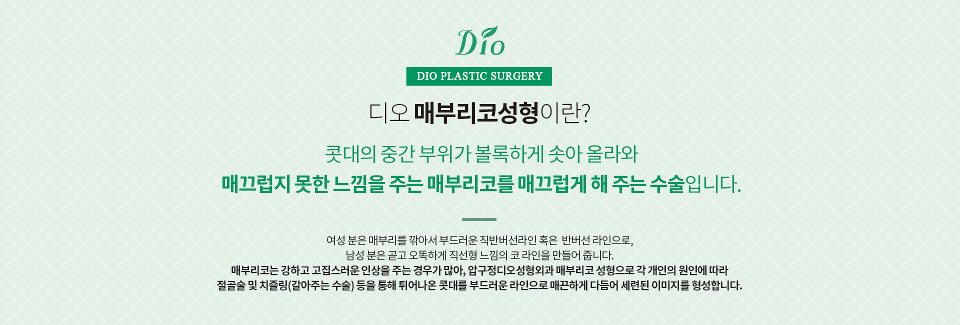 메부리코성형이란? 