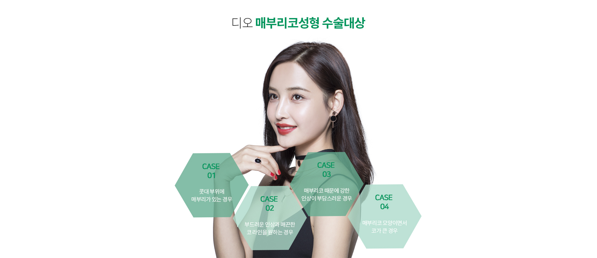 메부리코성형이 필요한경우