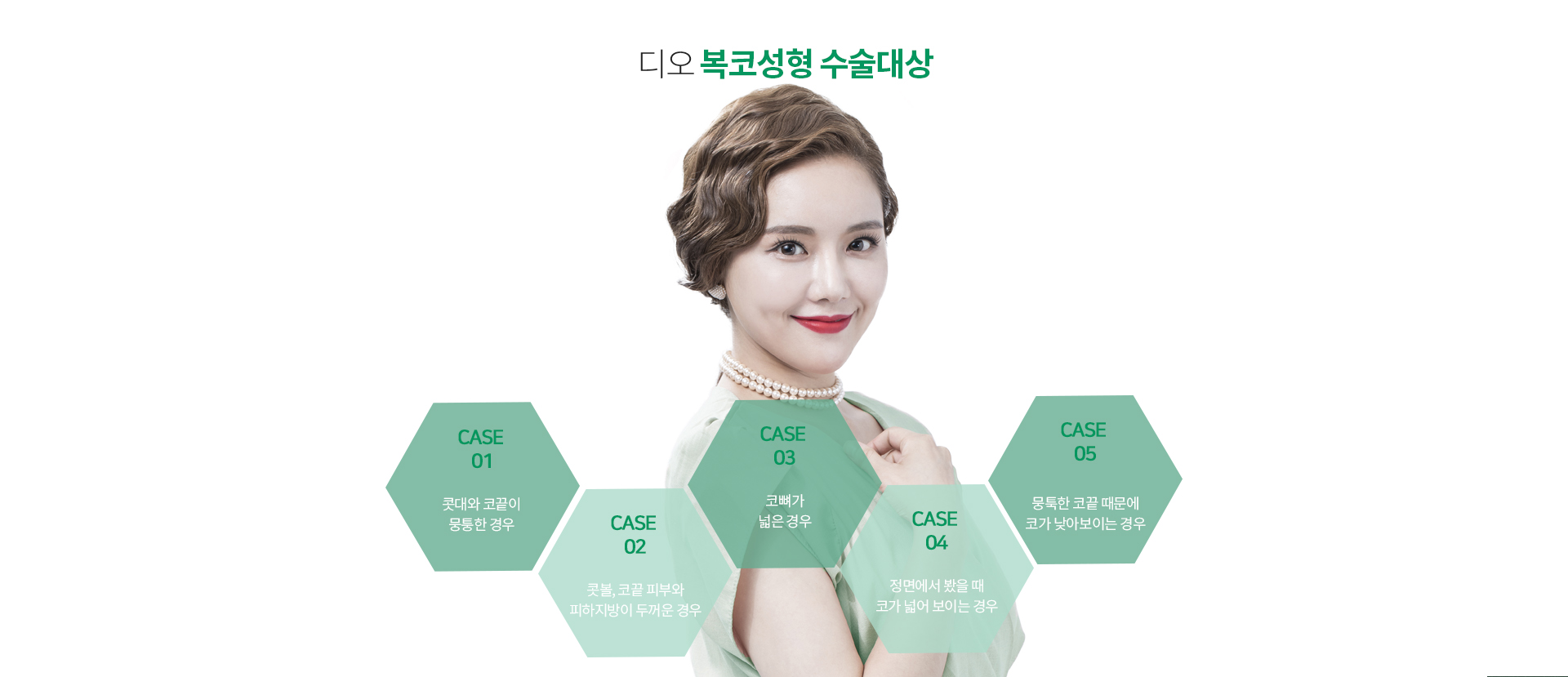 복코성형이 필요한경우