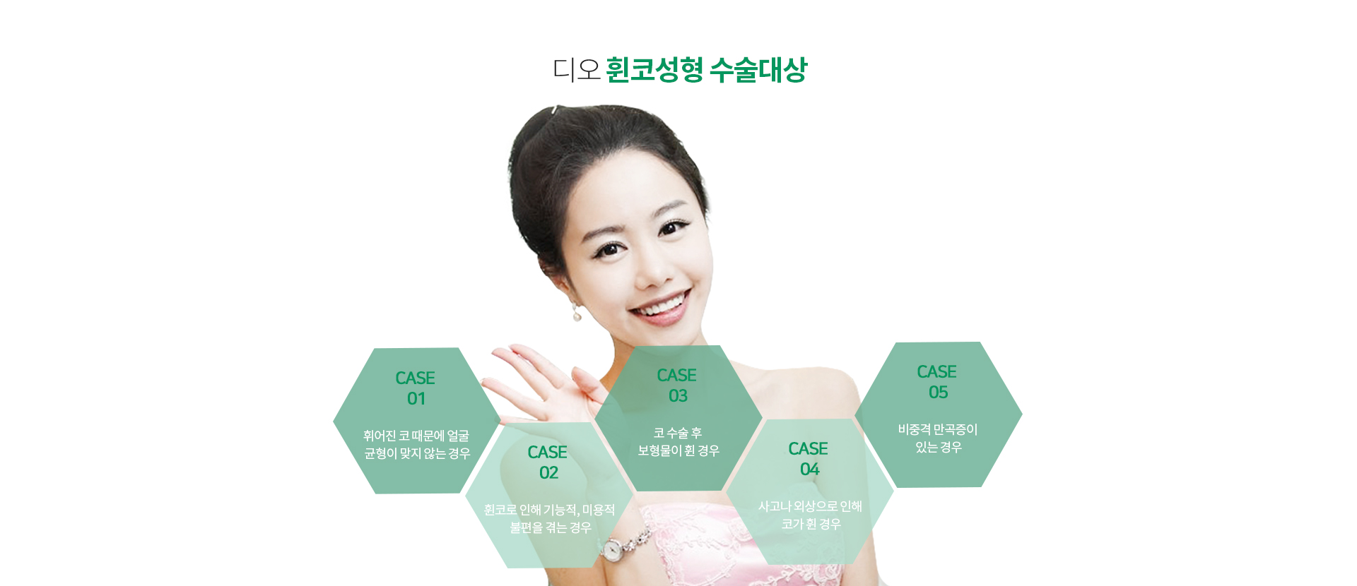 휜코성형이 필요한경우