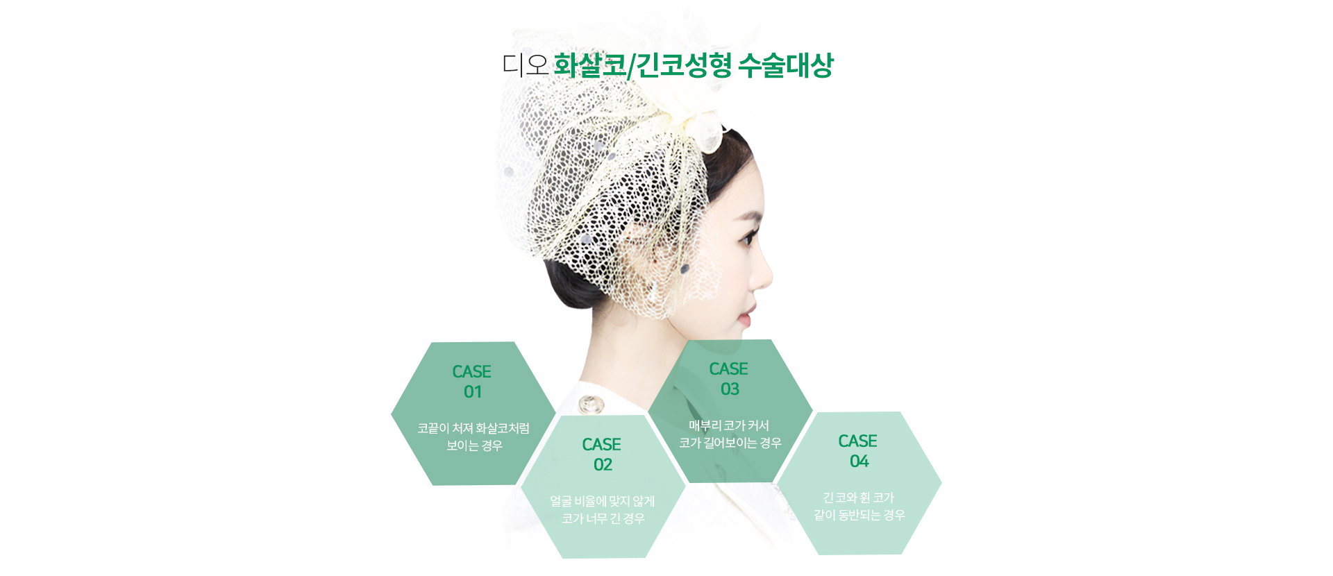 화살코/긴코성형이 필요한경우
